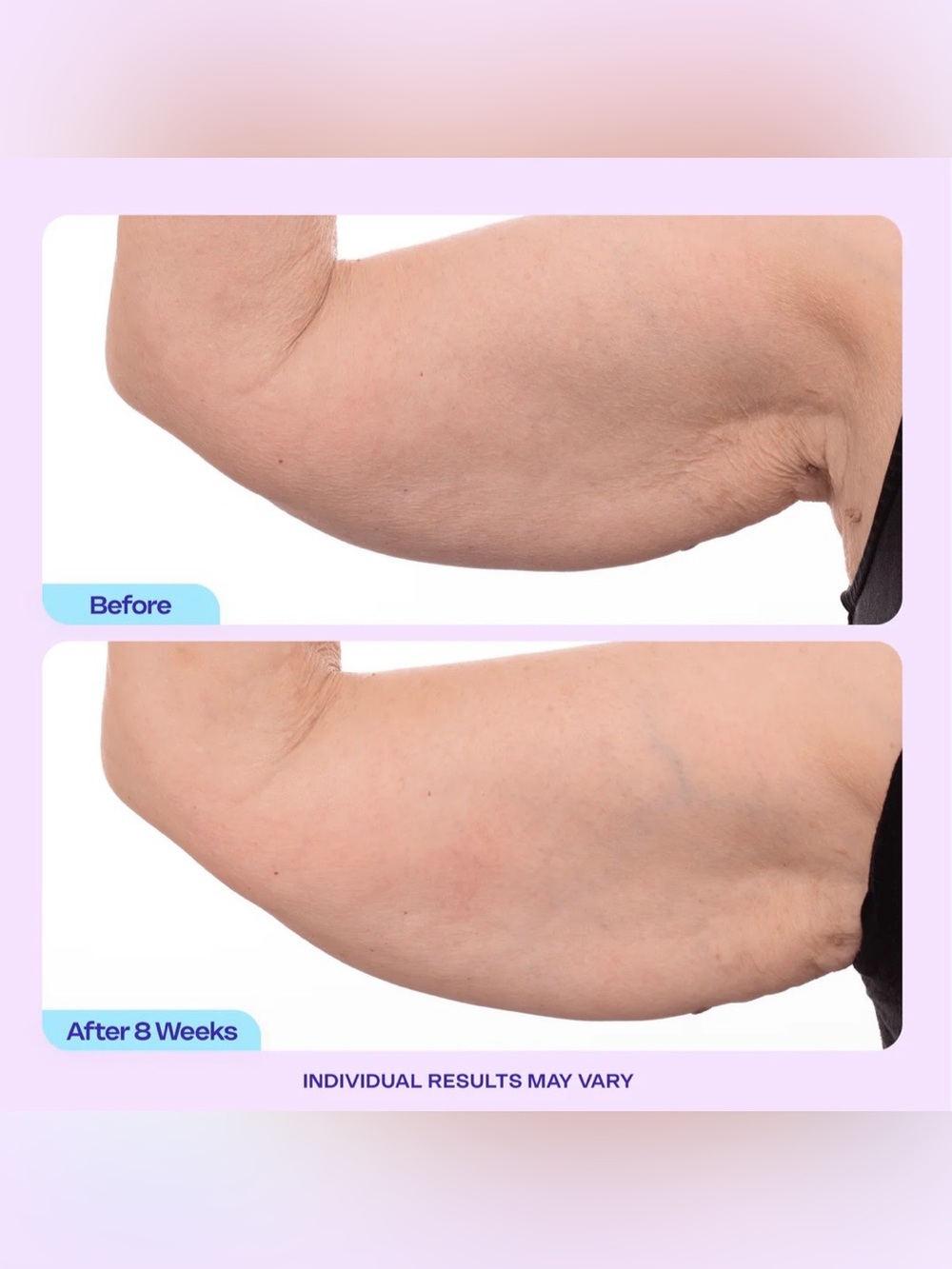 GOPURE Sculpt & Tone Arm Cream - Picture 5 of 13